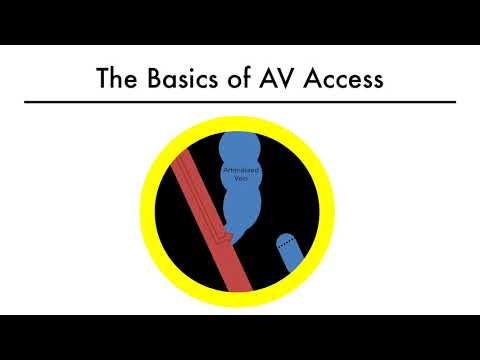 Accesul la hemodializă 101 01 – Elementele de bază ale accesului AV